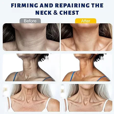 Firm and Smooth the Look ofYour Neck.Reveal Younger-LookingSkin.