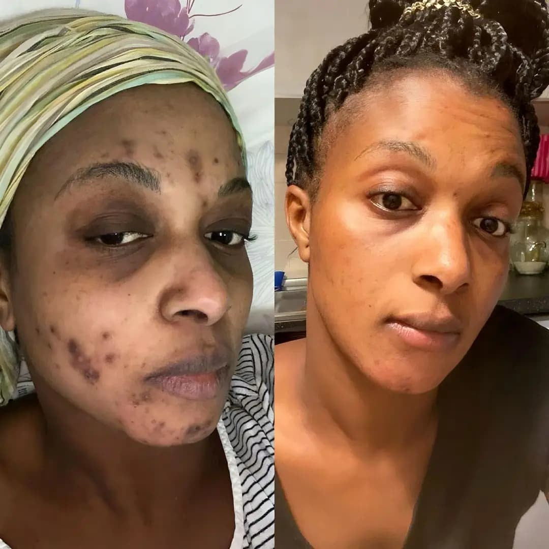 Triple Green Tea Enzyme Peeling Gel