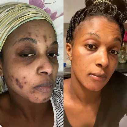 Triple Green Tea Enzyme Peeling Gel