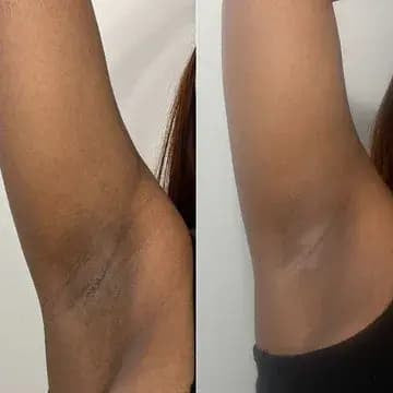 Triple Green Tea Enzyme Peeling Gel