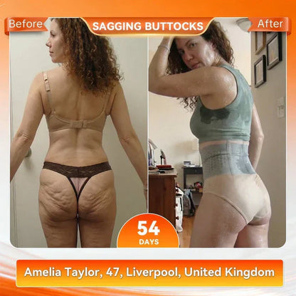 4-In-1 Micro-Particle Sculpting & Fat-Burn Shorts